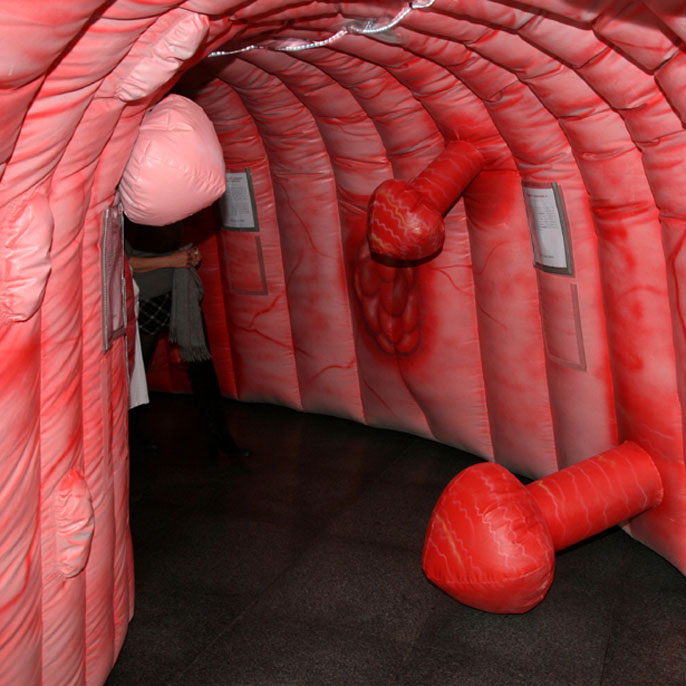 Cancer colorectal. Stand d’info et côlon géant, ce 6 mars, à MontLégia